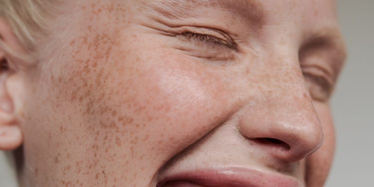 I Do Oil Pulling Every Morning—Here Are the Benefits