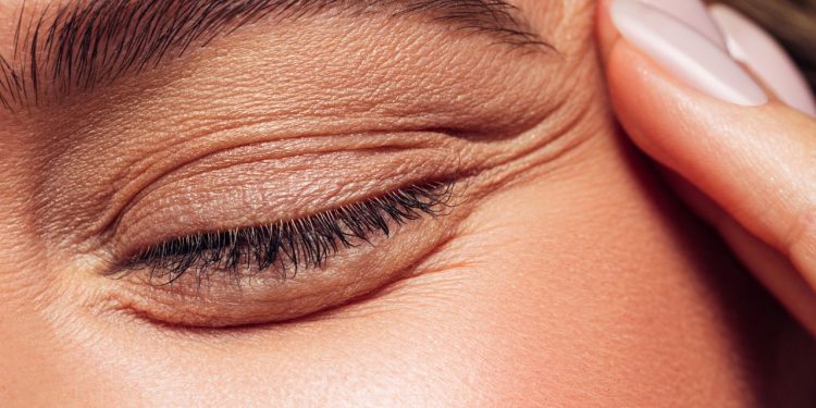 How Lactic Acid Can Improve Your Skin, According To The Experts