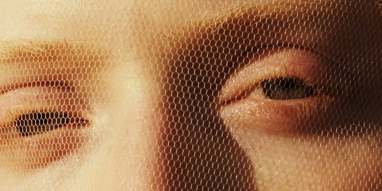 How Safe Is Radiofrequency Microneedling, Really?