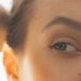 This Dermatologist’s Tip Helped My Dark Circles